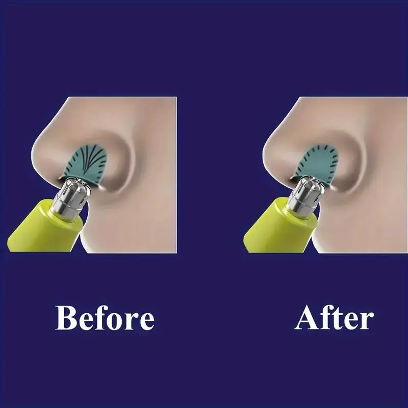 OneBlade & One Blade QP2520 QP - Electric Shaver Rotary incelemesi ve fiyatı